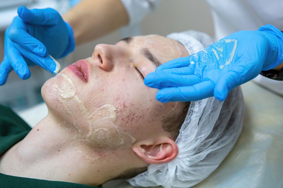 Young man receiving an acne facial treatment